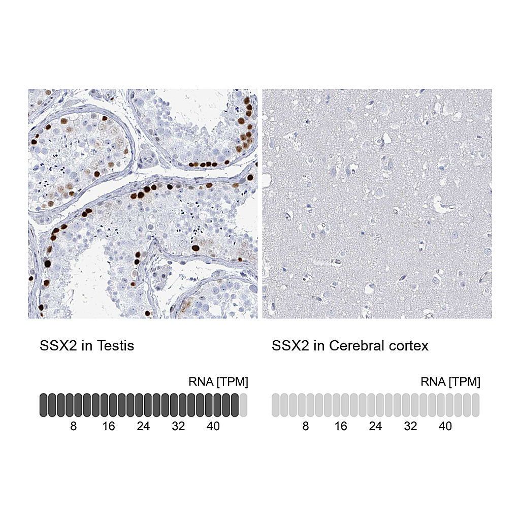 Atlas Antibodies Anti-SSX2 Antibody
