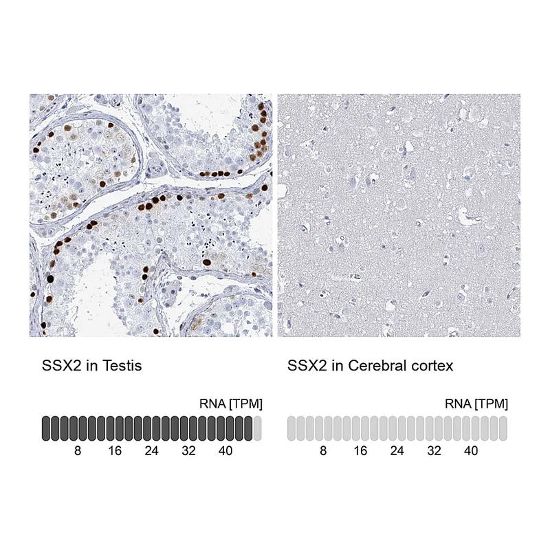Atlas Antibodies Anti-SSX2 Antibody