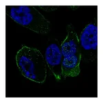 Atlas Antibodies Anti-SSTR5 Antibody