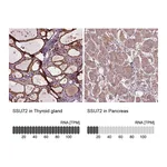 Atlas Antibodies Anti-SSU72 Antibody