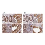 Atlas Antibodies Anti-ST13 Antibody