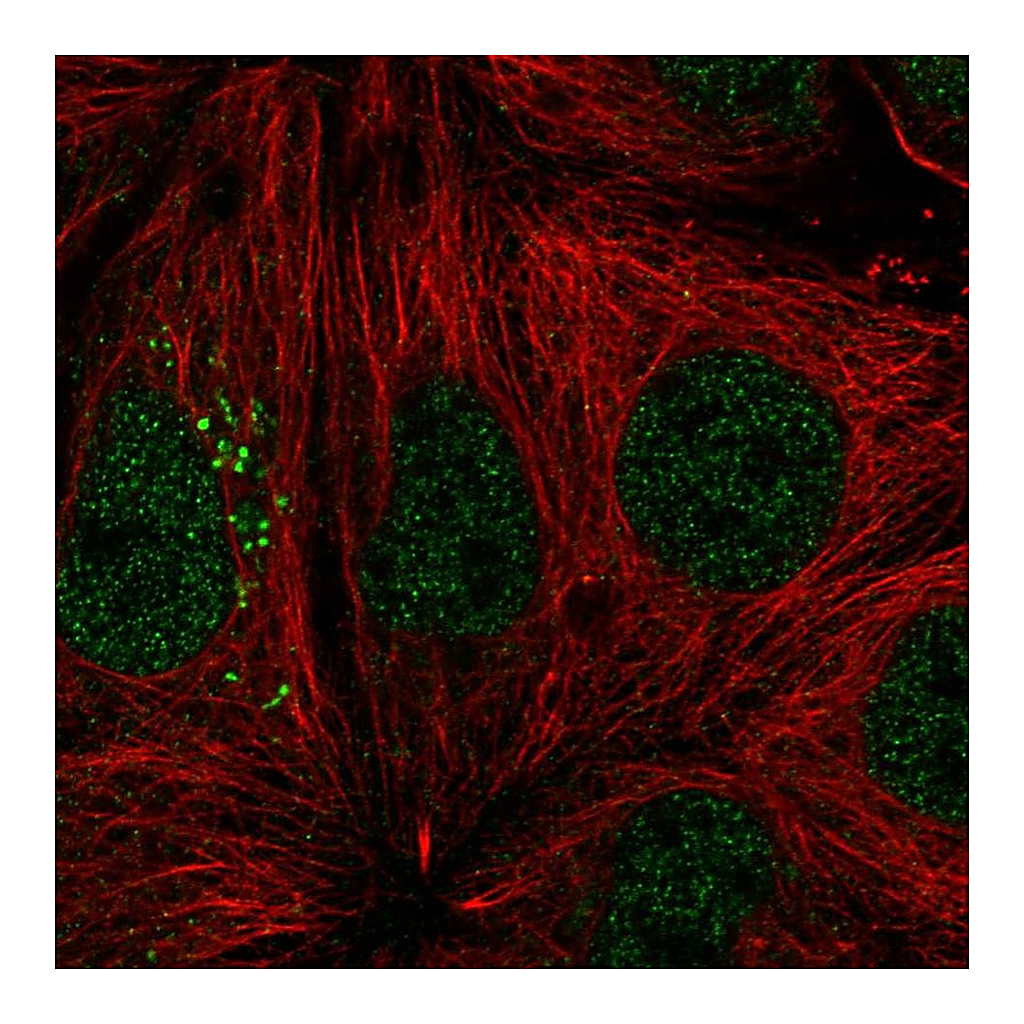 Atlas Antibodies Anti-ST14 Antibody