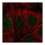 Atlas Antibodies Anti-ST14 Antibody