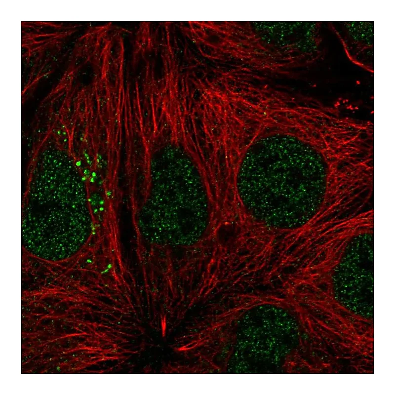 Atlas Antibodies Anti-ST14 Antibody