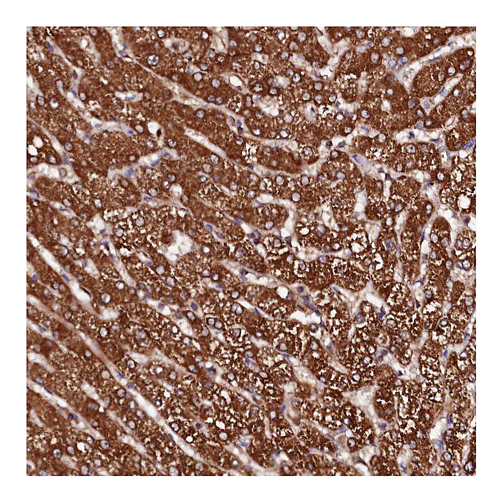 Atlas Antibodies Anti-ST3GAL1 Antibody