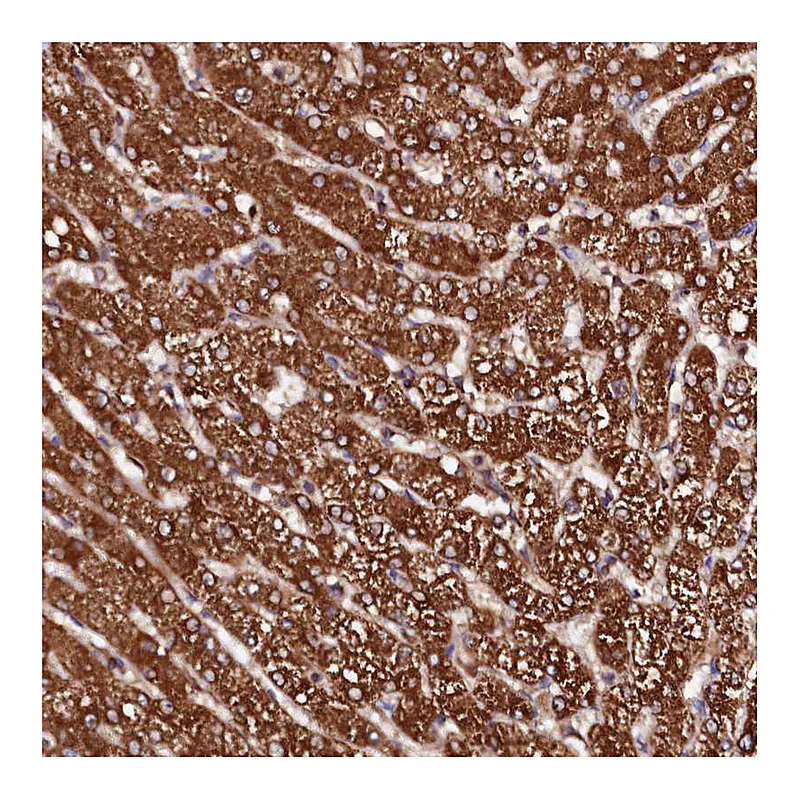 Atlas Antibodies Anti-ST3GAL1 Antibody