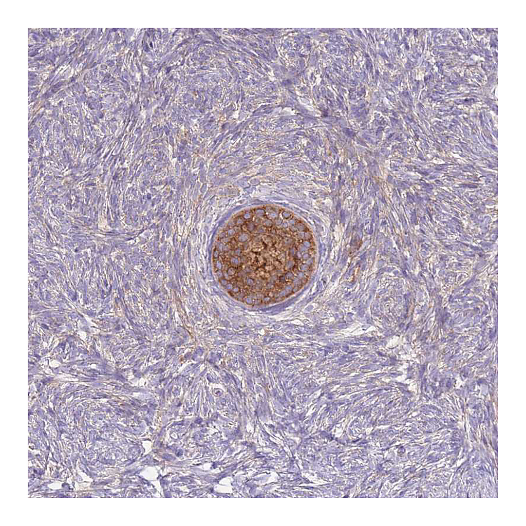 Atlas Antibodies Anti-ST3GAL4 Antibody