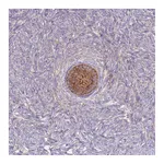 Atlas Antibodies Anti-ST3GAL4 Antibody