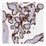 Atlas Antibodies Anti-ST3GAL5 Antibody