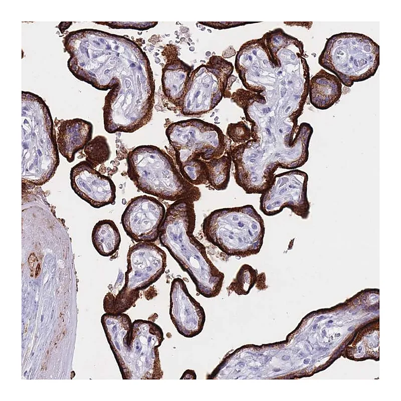 Atlas Antibodies Anti-ST3GAL5 Antibody
