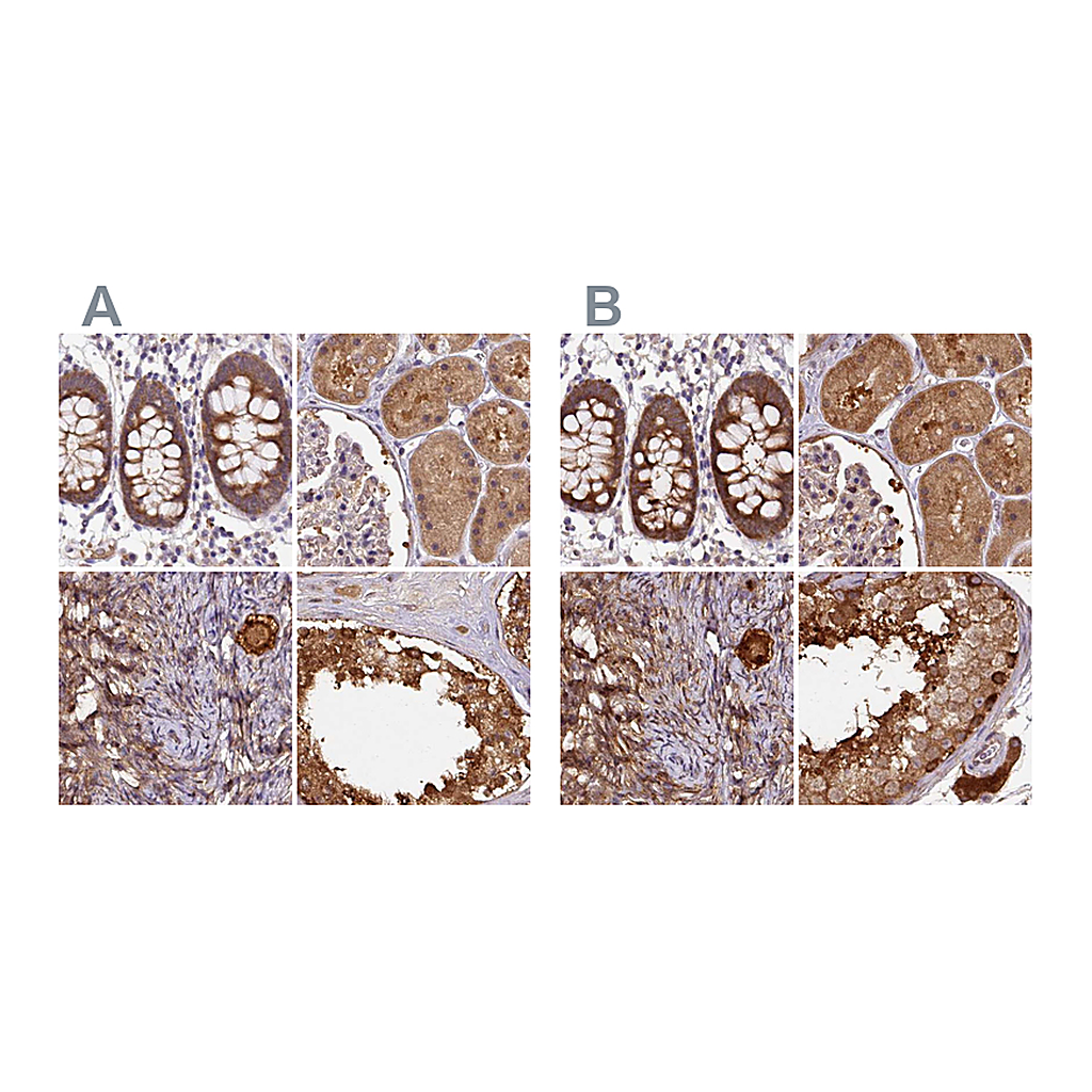 Atlas Antibodies Anti-ST13 Antibody
