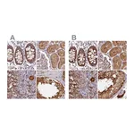 Atlas Antibodies Anti-ST13 Antibody