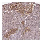 Atlas Antibodies Anti-ST13 Antibody