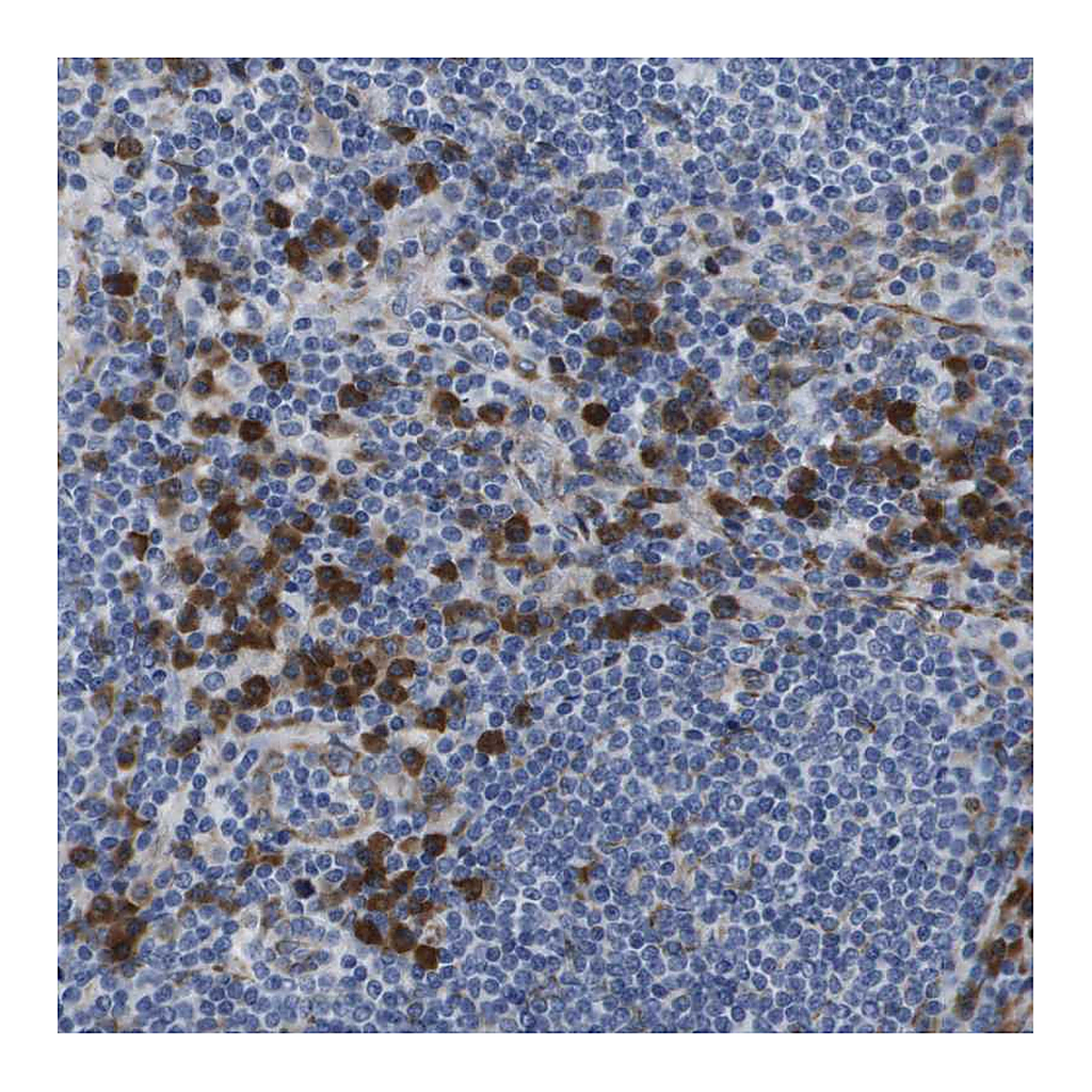 Atlas Antibodies Anti-ST3GAL2 Antibody