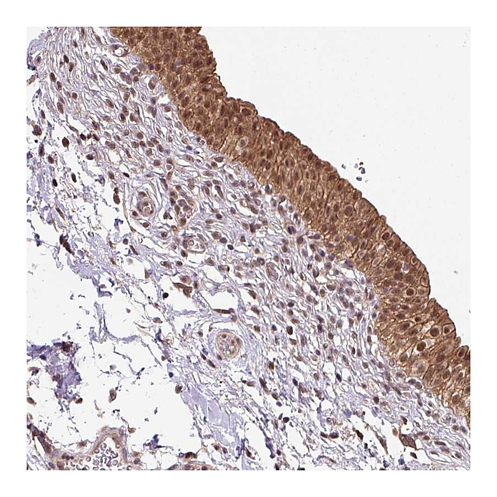 Atlas Antibodies Anti-ST13 Antibody