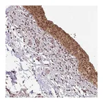 Atlas Antibodies Anti-ST13 Antibody