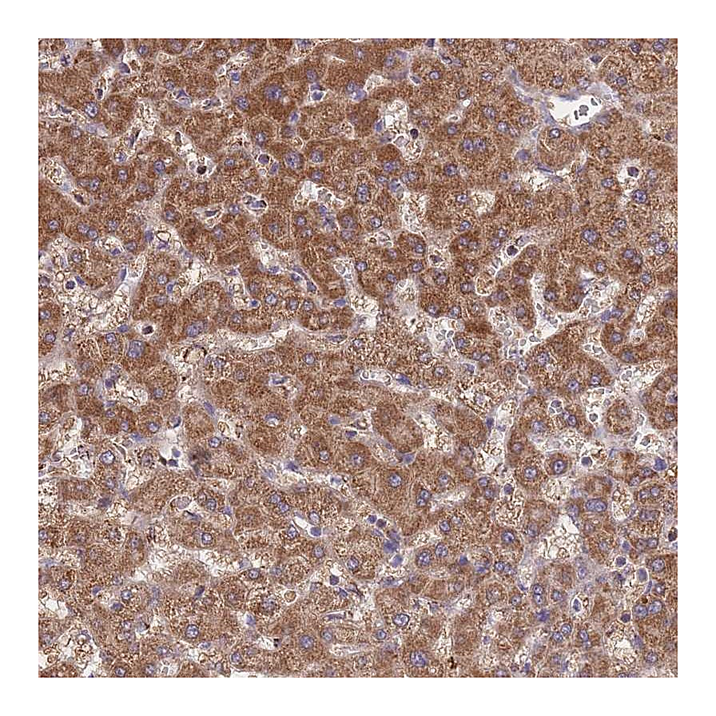 Atlas Antibodies Anti-ST3GAL3 Antibody