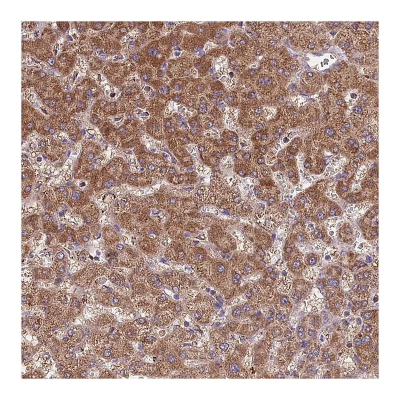 Atlas Antibodies Anti-ST3GAL3 Antibody
