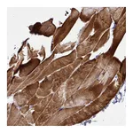 Atlas Antibodies Anti-ST6GALNAC3 Antibody