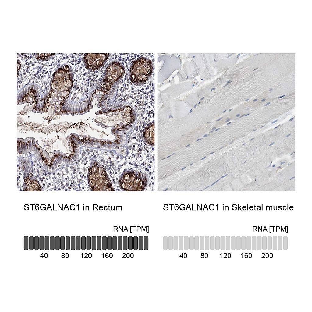 Atlas Antibodies Anti-ST6GALNAC1 Antibody