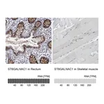 Atlas Antibodies Anti-ST6GALNAC1 Antibody