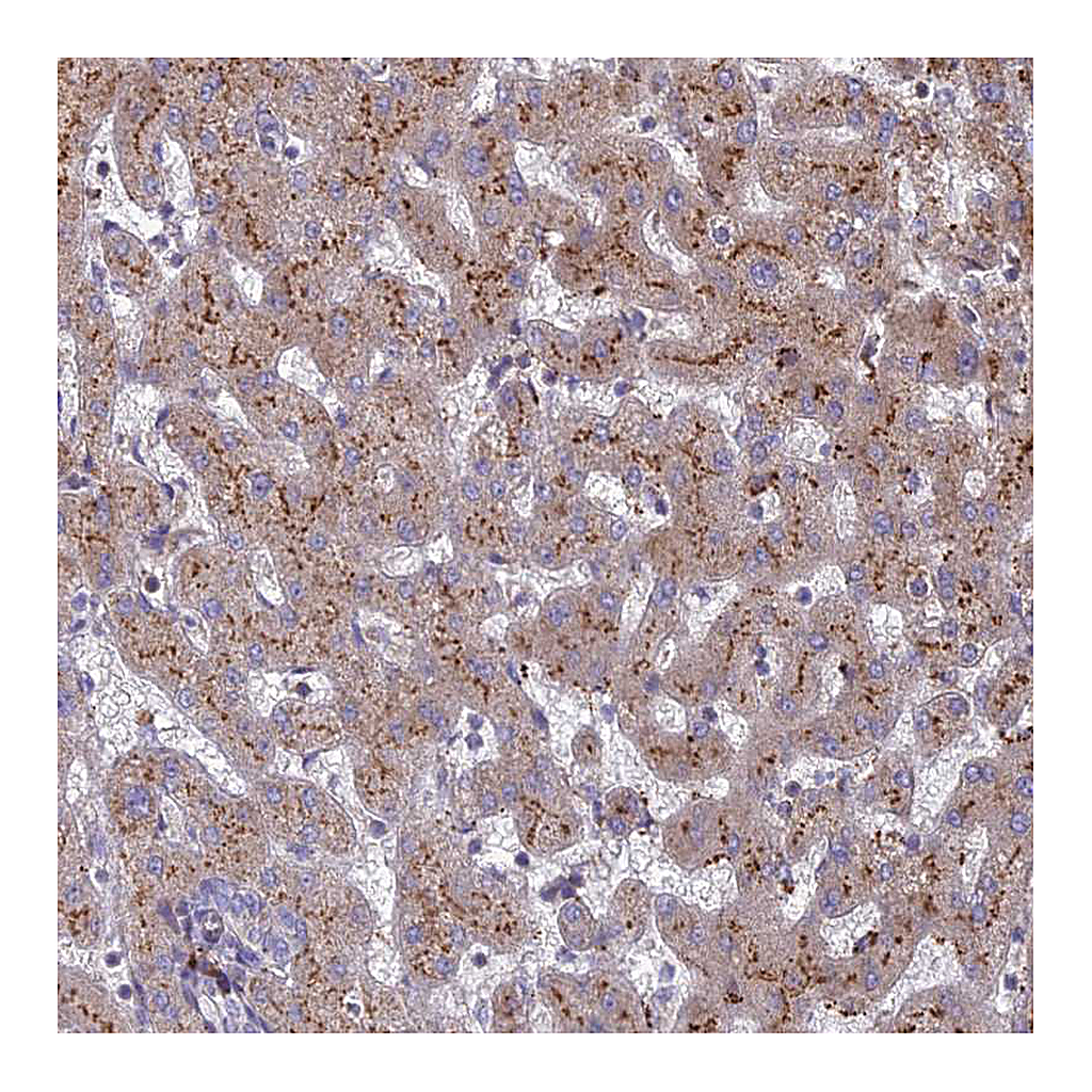 Atlas Antibodies Anti-ST3GAL6 Antibody