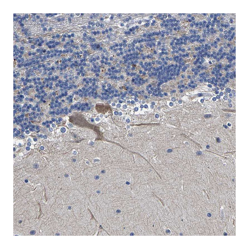 Atlas Antibodies Anti-ST6GAL2 Antibody