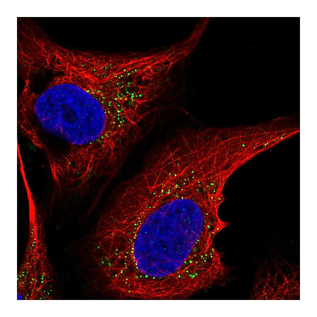Atlas Antibodies Anti-ST6GALNAC5 Antibody