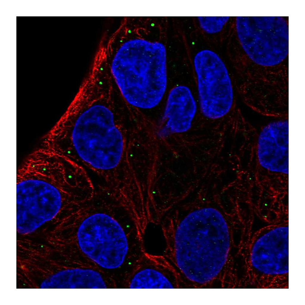 Atlas Antibodies Anti-ST3GAL5 Antibody