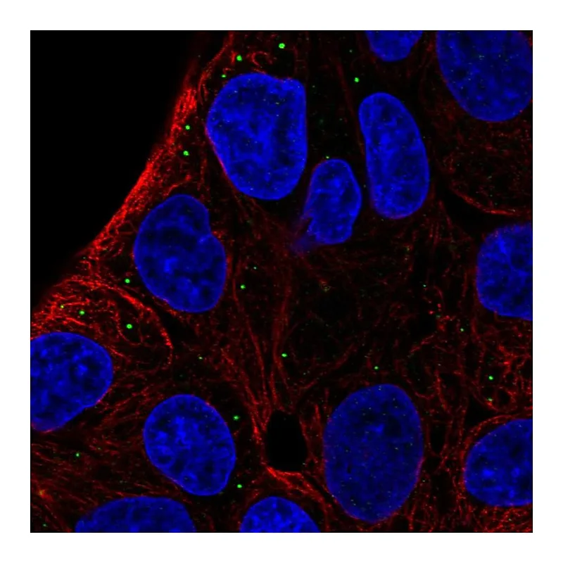 Atlas Antibodies Anti-ST3GAL5 Antibody