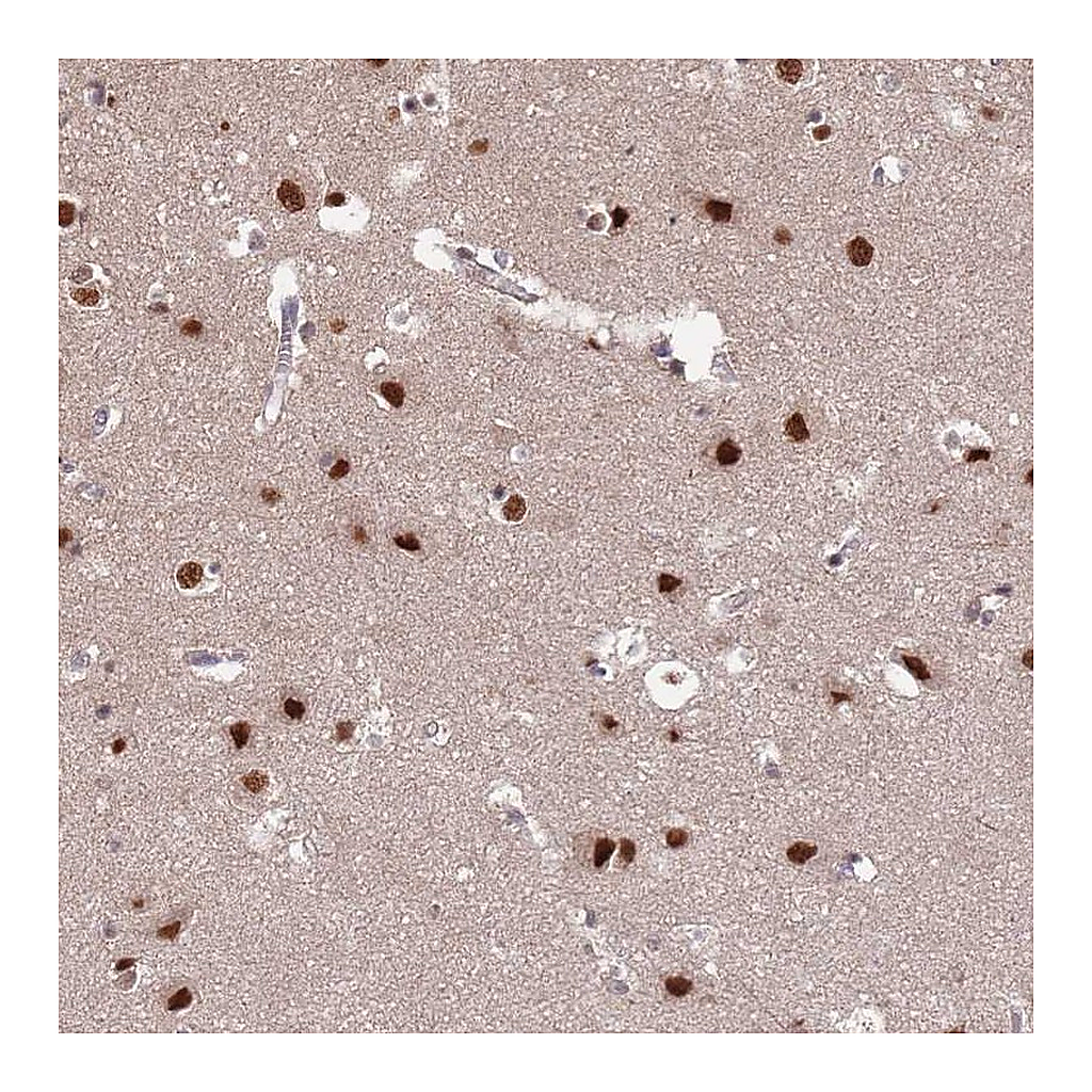 Atlas Antibodies Anti-ST5 Antibody