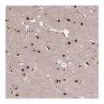 Atlas Antibodies Anti-ST5 Antibody