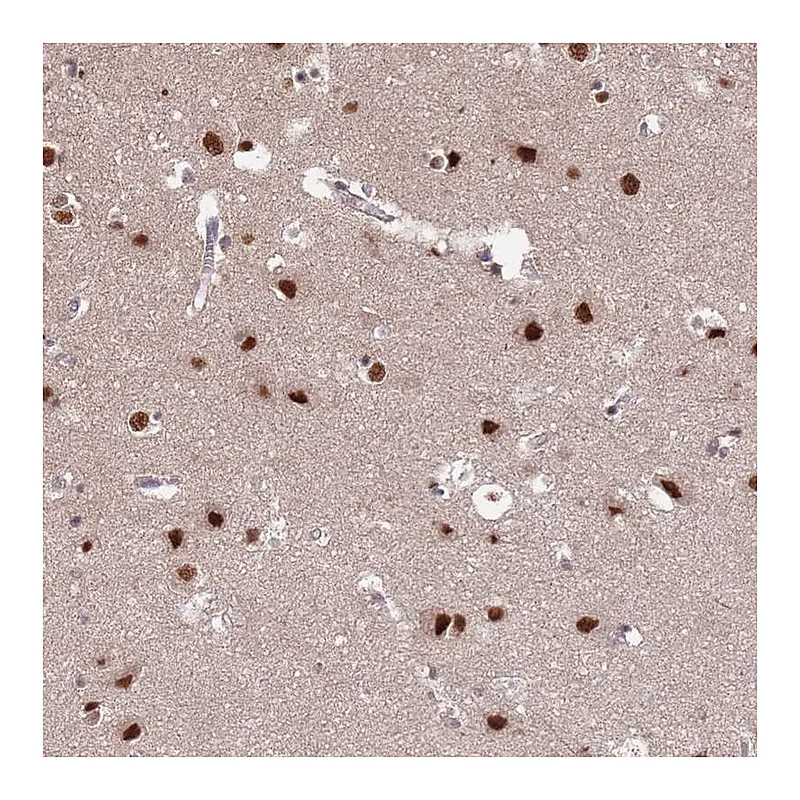 Atlas Antibodies Anti-ST5 Antibody