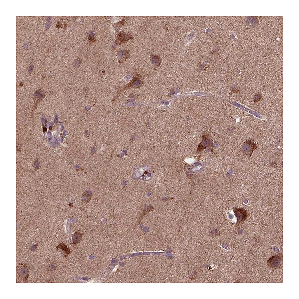 Atlas Antibodies Anti-ST6GALNAC5 Antibody