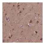 Atlas Antibodies Anti-ST6GALNAC5 Antibody