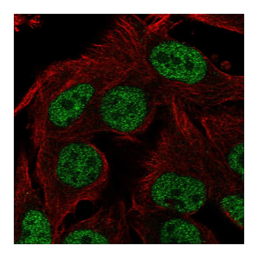 Atlas Antibodies Anti-ST6GALNAC3 Antibody