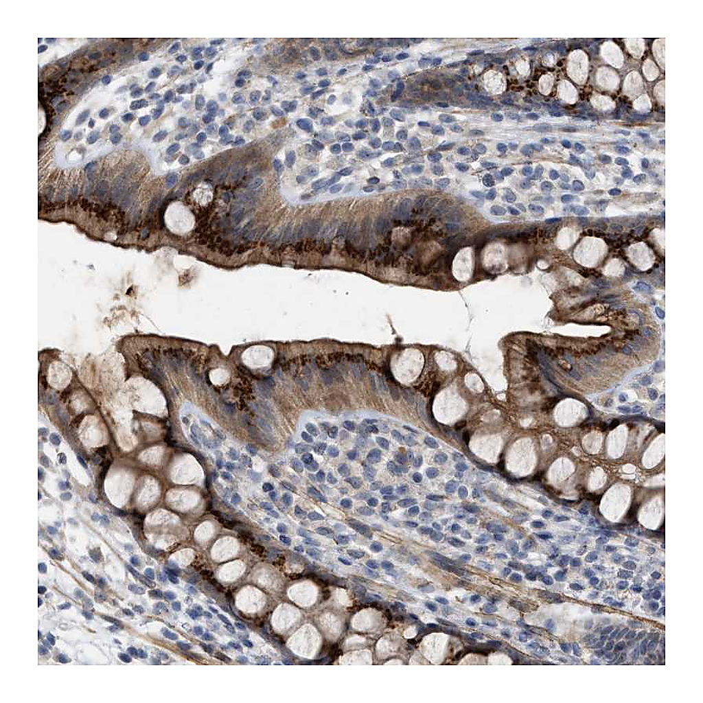 Atlas Antibodies Anti-ST6GALNAC6 Antibody
