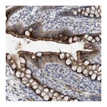 Atlas Antibodies Anti-ST6GALNAC6 Antibody