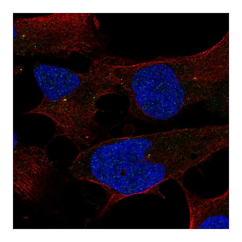 Atlas Antibodies Anti-ST7L Antibody