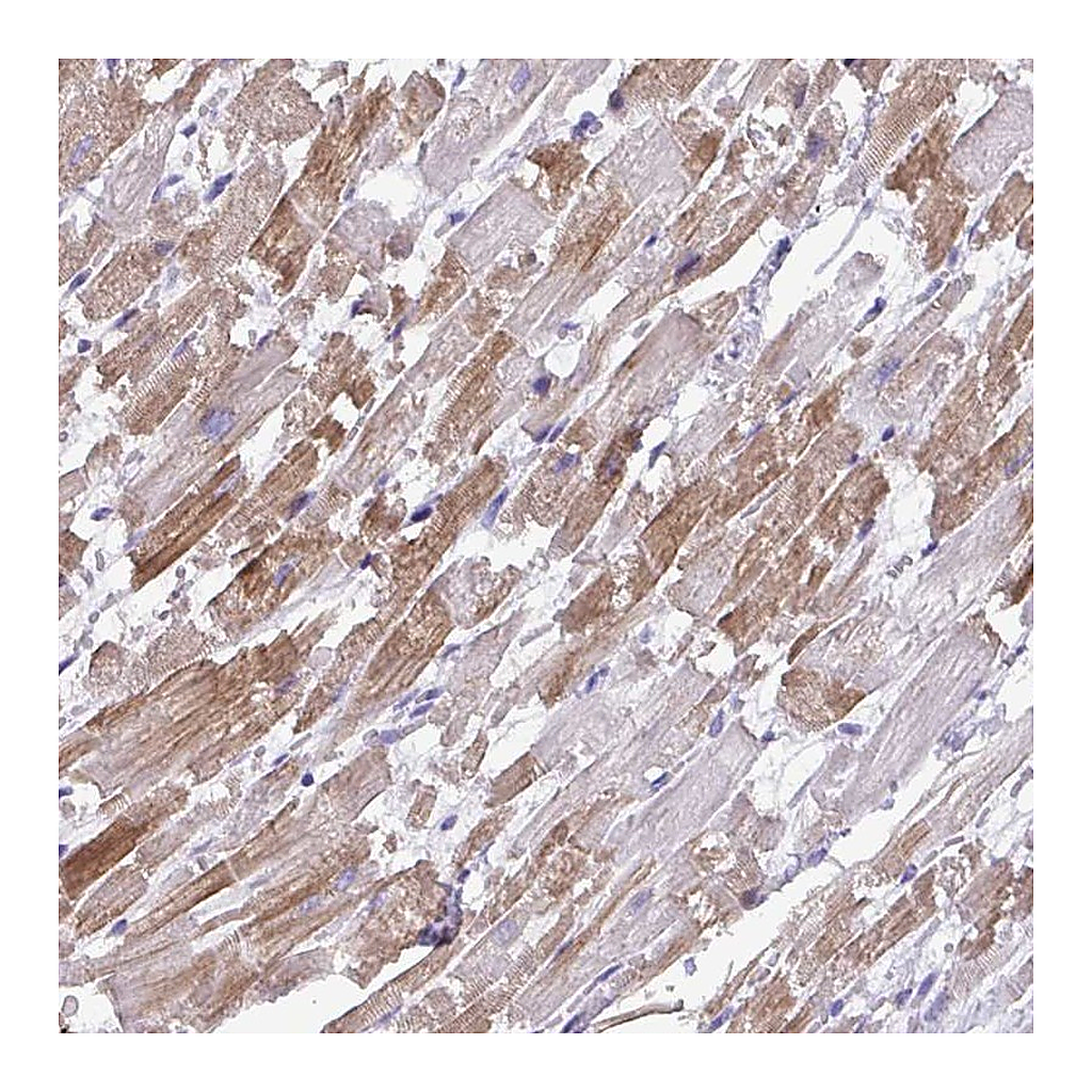 Atlas Antibodies Anti-ST8SIA2 Antibody