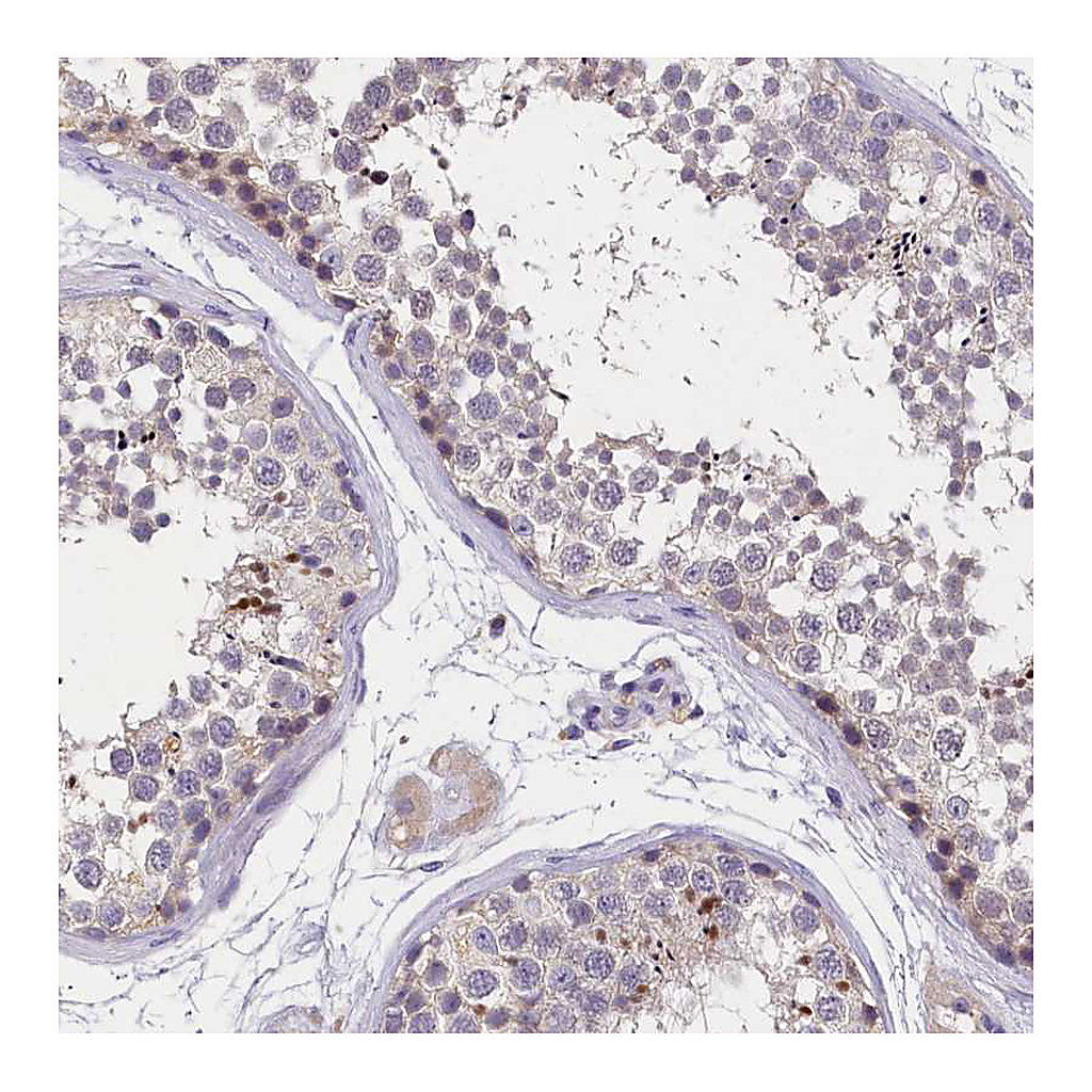 Atlas Antibodies Anti-ST7L Antibody