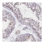 Atlas Antibodies Anti-ST7L Antibody