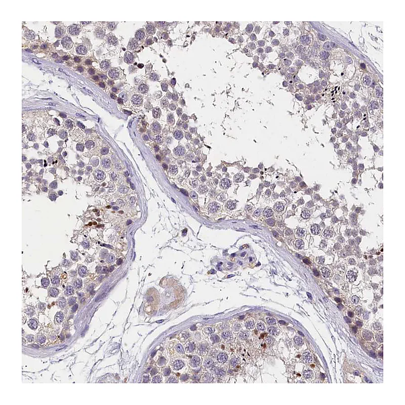Atlas Antibodies Anti-ST7L Antibody
