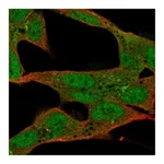 Atlas Antibodies Anti-ST8SIA2 Antibody
