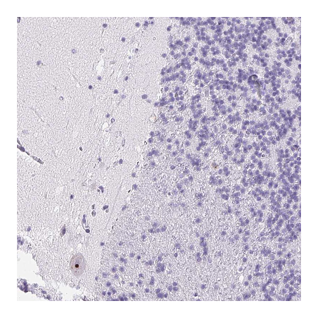 Atlas Antibodies Anti-ST8SIA3 Antibody