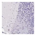 Atlas Antibodies Anti-ST8SIA3 Antibody