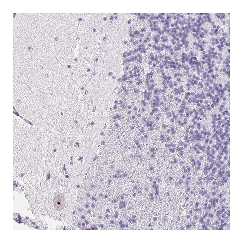 Atlas Antibodies Anti-ST8SIA3 Antibody