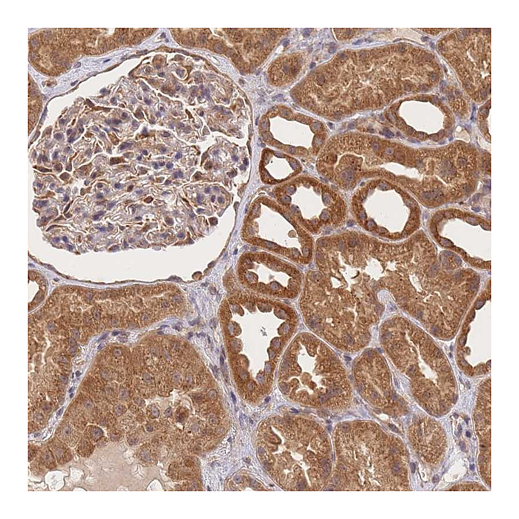 Atlas Antibodies Anti-ST8SIA4 Antibody