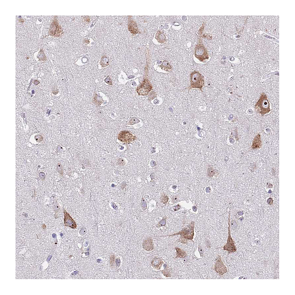 Atlas Antibodies Anti-ST8SIA5 Antibody