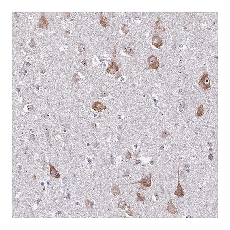 Atlas Antibodies Anti-ST8SIA5 Antibody
